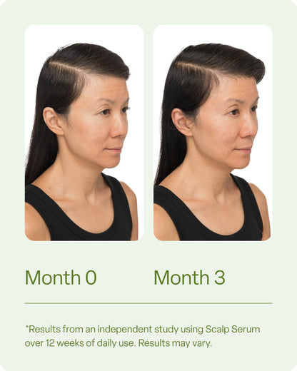 Divi Healthy Hair Bundle: Scalp Serum 1 fl oz and Hair Vitamins, 30-Day Supply