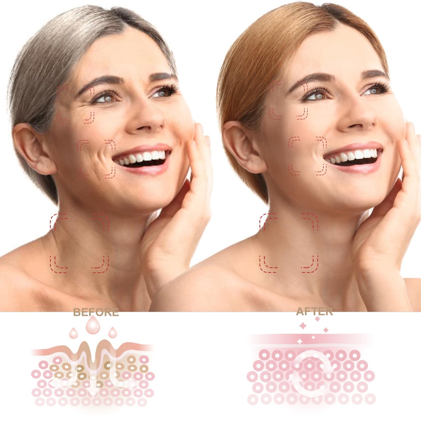 Face and Neck Skin Care Light Therapy