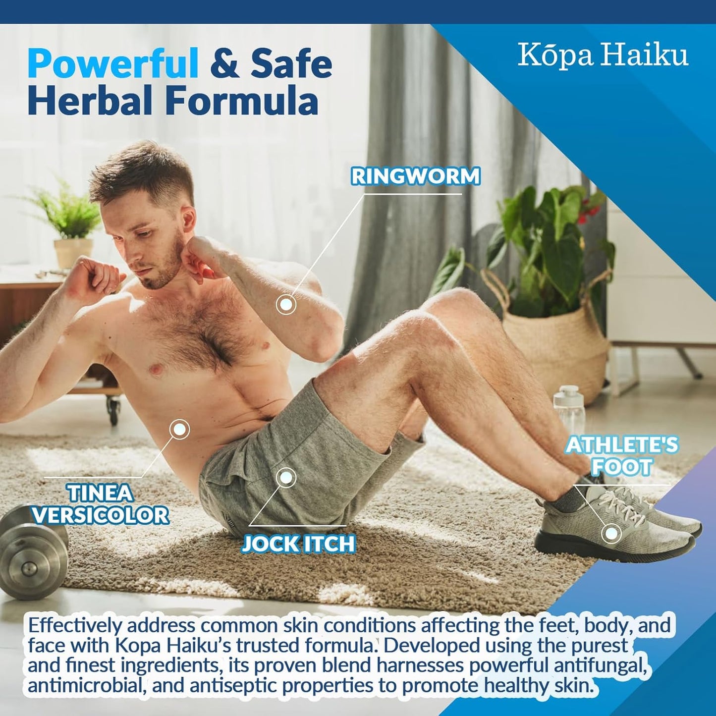 Extra Strength Skin Care Cream for Men and Women   Foot and Body Care(20g) *Exp 3/27*