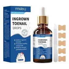 Ingrown Toenail Drops (EXP:10/26)