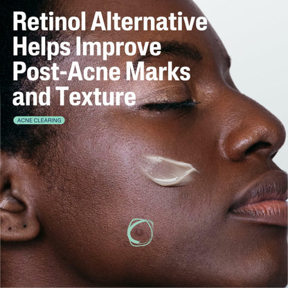 CETAPHIL Gentle Clear Repairing Post-Acne Serumd
