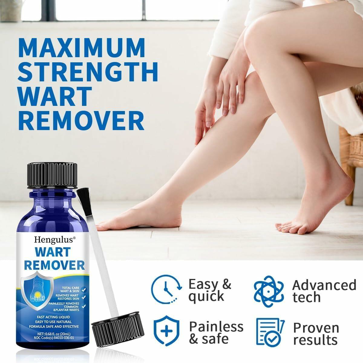 Wart Removal Cream, Salicylic Wart Remover