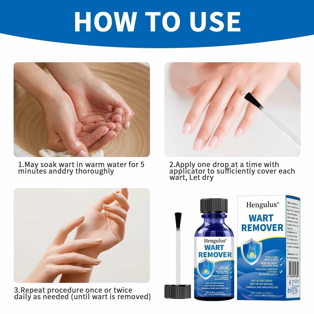 Wart Removal Cream, Salicylic Wart Remover