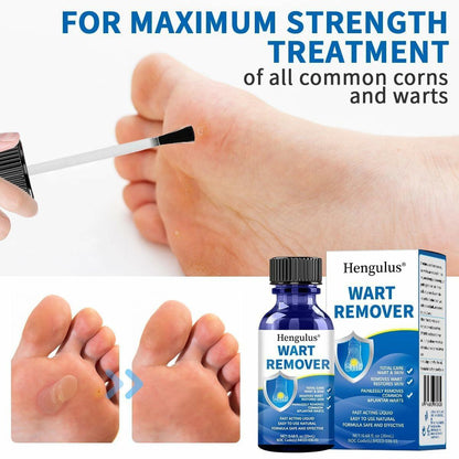 Wart Removal Cream, Salicylic Wart Remover