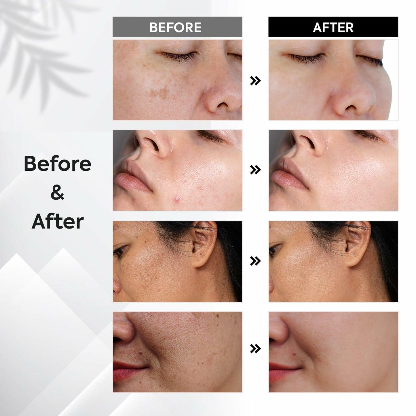 Dark Spot Remover for Face and Body